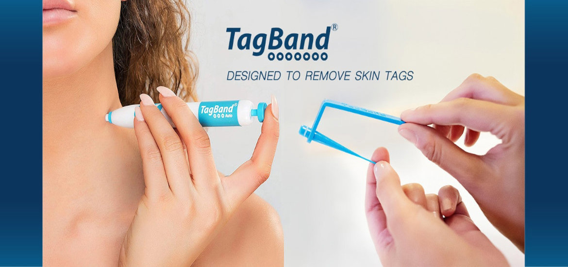 TagBand UK 